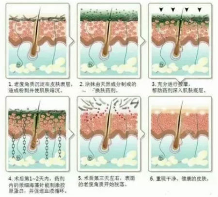 NEWNEW|修復(fù)痘坑痘印還得靠海藻煥膚