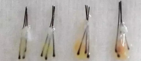 iGLORY完美睫毛增長(zhǎng)液，喚醒睫毛逆生長(zhǎng)，30天睫毛長(zhǎng)一倍