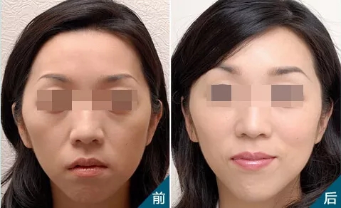 無針?biāo)猓瑧{什么讓女性為之瘋狂和傾倒？！