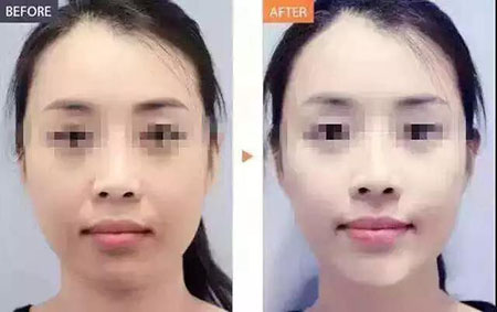 還在靠敷面膜補(bǔ)水？那你的皮膚肯定出問(wèn)題！