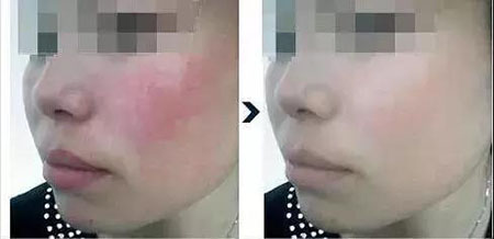 還在靠敷面膜補(bǔ)水？那你的皮膚肯定出問(wèn)題！