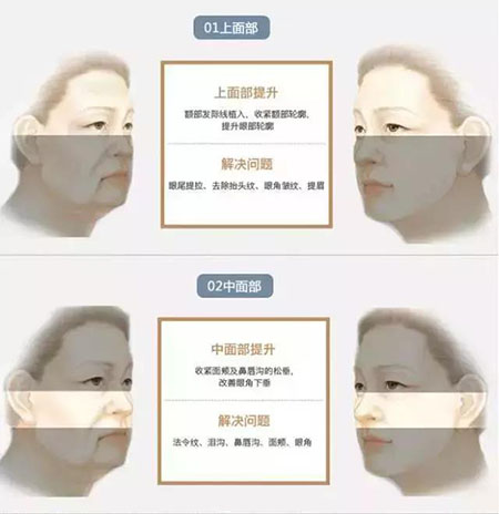 她只是做了個(gè)黃金V雕，3年后結(jié)果震驚了所有人！