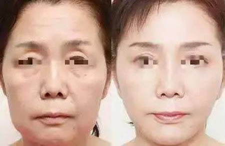 她只是做了個(gè)黃金V雕，3年后結(jié)果震驚了所有人！