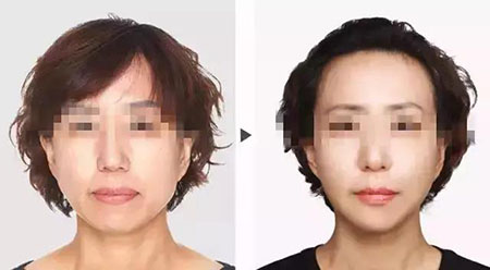 她只是做了個(gè)黃金V雕，3年后結(jié)果震驚了所有人！