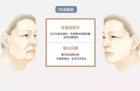 她只是做了個(gè)黃金V雕，3年后結(jié)果震驚了所有人！