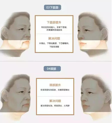 她只是做了個(gè)黃金V雕，3年后結(jié)果震驚了所有人！