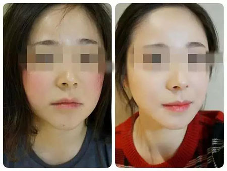 拒絕春季過敏、紅腫、發(fā)癢！敏感肌的救星來啦~