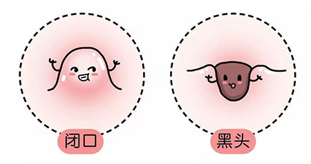 “閉口”這個磨人的小妖精又出來作妖啦！