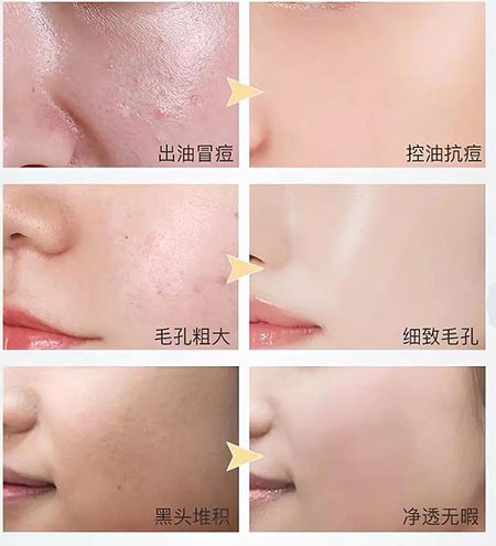 韓詩緹教你正確洗臉，現(xiàn)在！立刻！馬上！改善皮膚問題