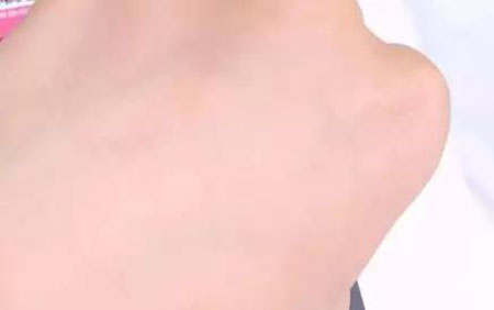 敏感肌不能化妝？良心推薦這款修復(fù)遮瑕霜！