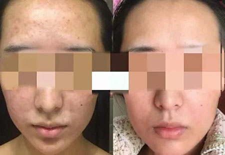 粉絲真實(shí)測(cè)評(píng)！DIY私人定制護(hù)膚品真有那么神奇嗎？