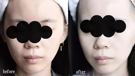 女人總愛摸這里，難怪會(huì)毀容，99%的人都中招！