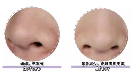 女人總愛摸這里，難怪會(huì)毀容，99%的人都中招！