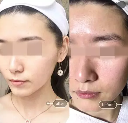“一洗白”能變白？假的！它才是美白正確的打開方式