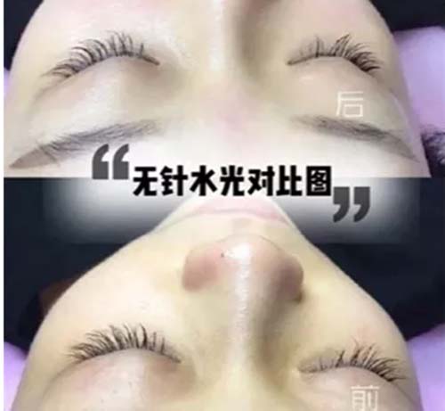 水光嫩膚管理凈化膚色、美白嫩膚