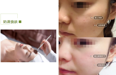 去暗黃、除色斑，VN美白管理讓你年輕十歲！