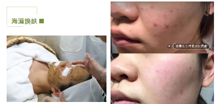 去暗黃、除色斑，VN美白管理讓你年輕十歲！