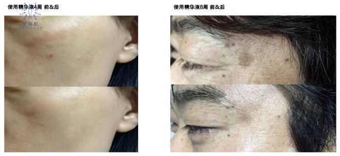 美業(yè)掘金內(nèi)幕｜院線護理“爆品打造”六要素