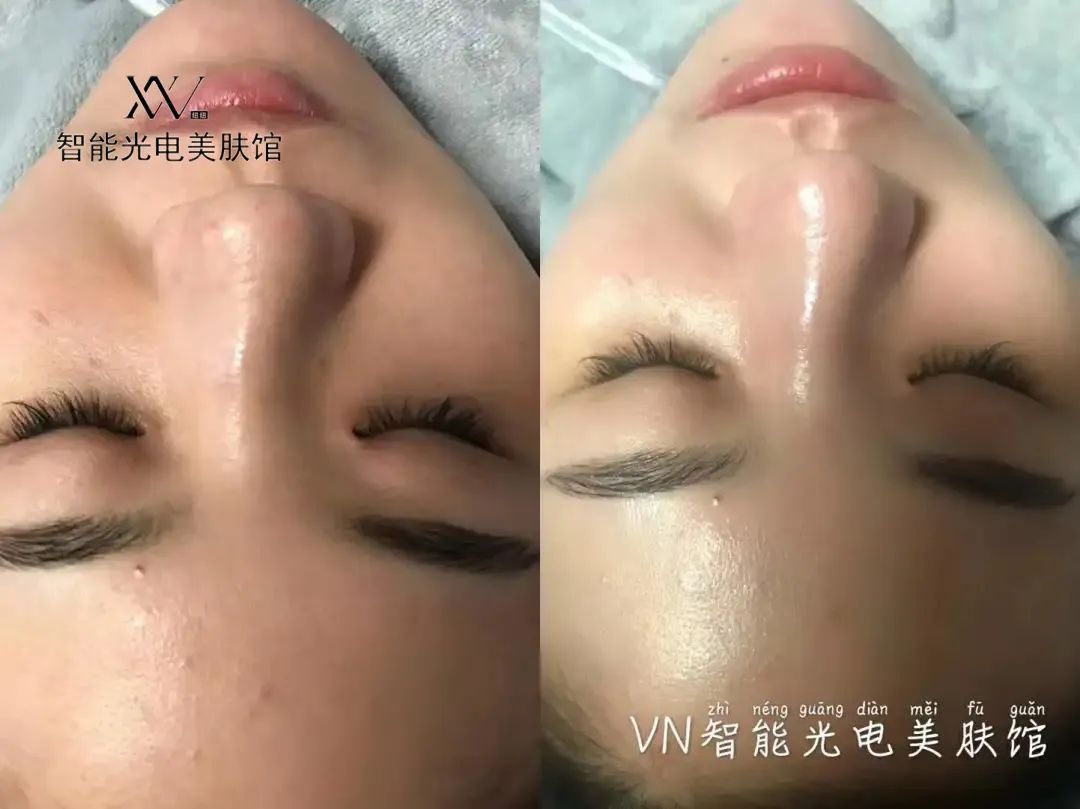 VN美業(yè)運(yùn)營(yíng)：掌握這5種需求，顧客追著你買單！