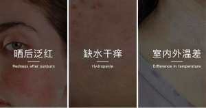 無(wú)懼時(shí)光，天生優(yōu)雅，敏感肌&受損肌的修護(hù)“膜”法
